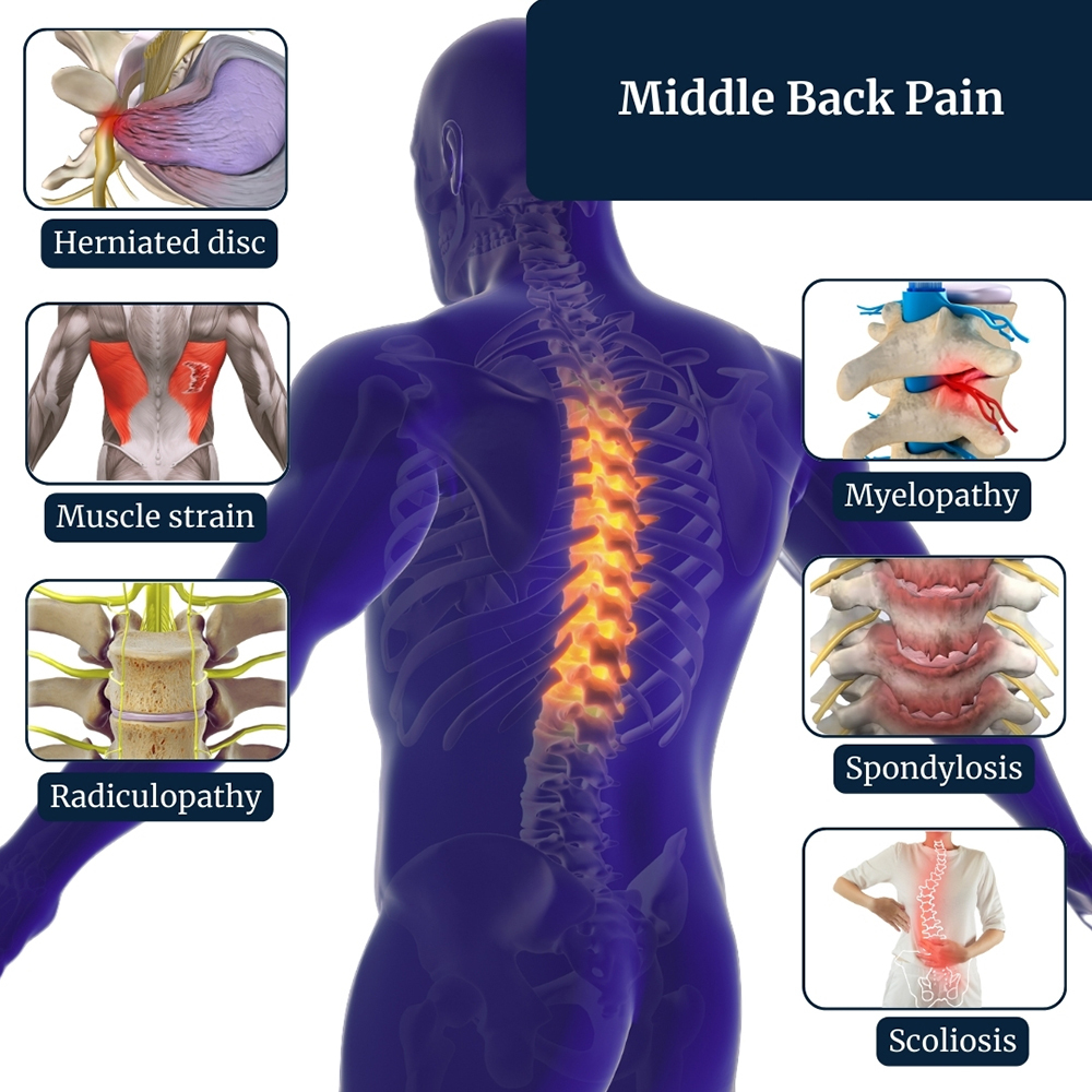 Middle Back Pain Treatment Irving, TX | Mid Back Pain Relief In Dallas, TX